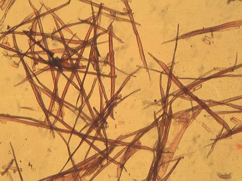 40倍生物显微镜下木纤维形态