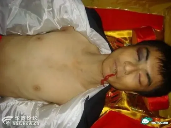 大学生赵伟火车站离奇死亡身上伤痕累累图